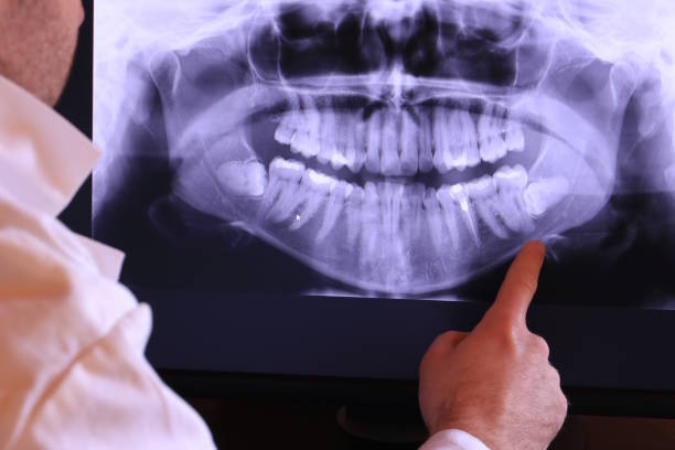 Best Broken or Cracked Tooth Emergency Dentist in Vinton, VA