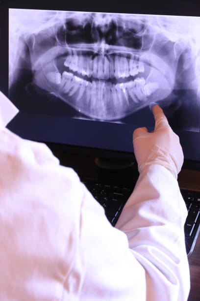 Best Emergency Dental Extractions in Vinton, VA