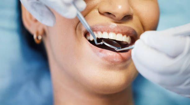 Best Holiday Emergency Dentist in Vinton, VA
