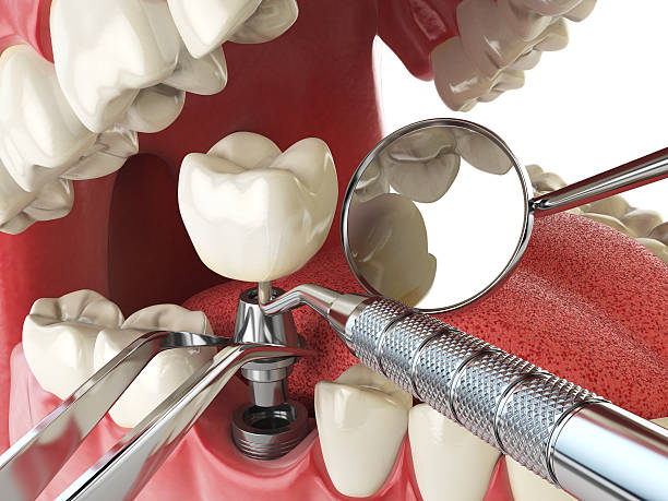 Best Emergency Dentist for Special Needs Patients in Vinton, VA